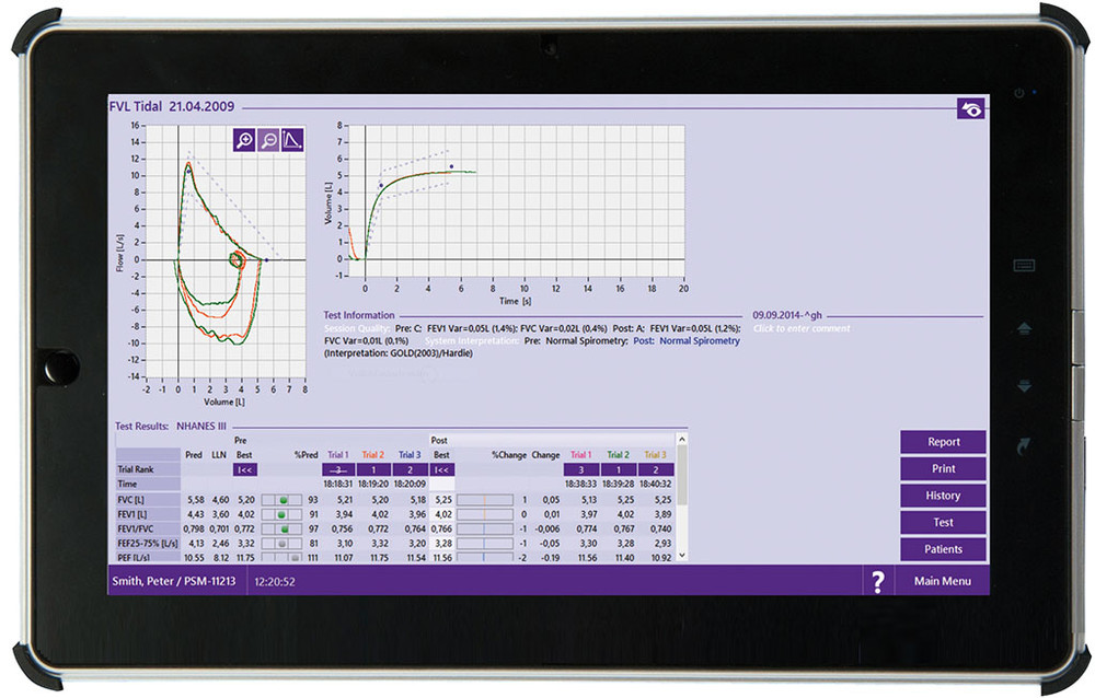 SPIROMETRE Easy on PC-SpeeDyn - Essormedical