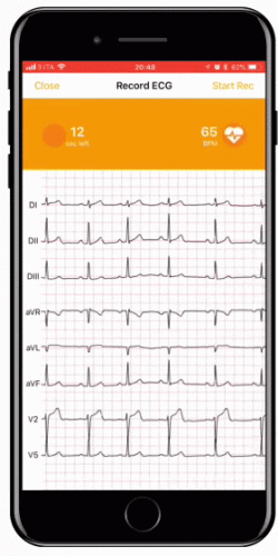 device-ecg-2